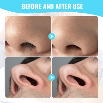 2-in-1 Nasal Hair Cutter, Nasal Hair Cutter,2024 New Double Sided Nose Hair Knife, 360° Rotating Nose Hair Clipper, Manual Nose Hair Trimmer with Ear Picker(Three colors,9pcs) - Image 5