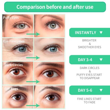 BREYLEE Aloe Vera Eye Mask 60 Pcs - Puffy Eyes and Dark Circles Treatments Look Younger and Reduce Wrinkles and Fine Lines Undereye, Improve and Firm eye Skin - Pure Natural Material Extraction - Image 3